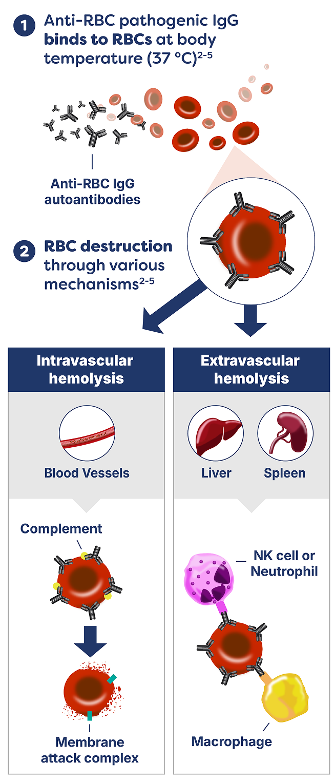 1. Anti-RBC pathogenic IgG binds to RBCs at body temperature (37° C). 2. RBC destruction through various mechanisms.