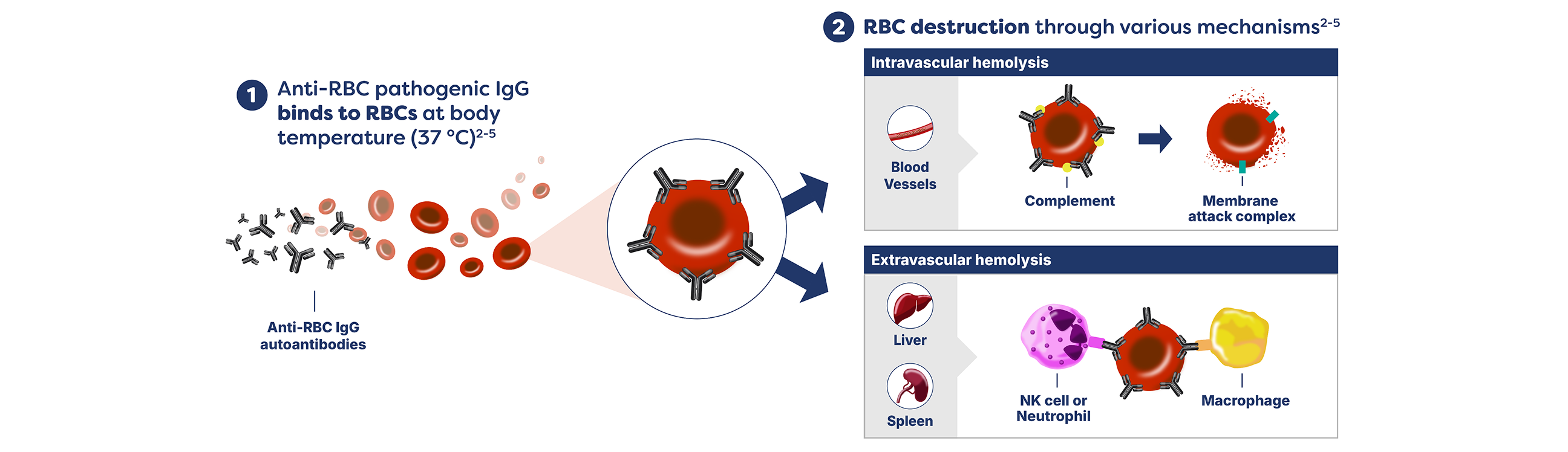 1. Anti-RBC pathogenic IgG binds to RBCs at body temperature (37° C). 2. RBC destruction through various mechanisms.